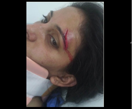 Mujer atropellada