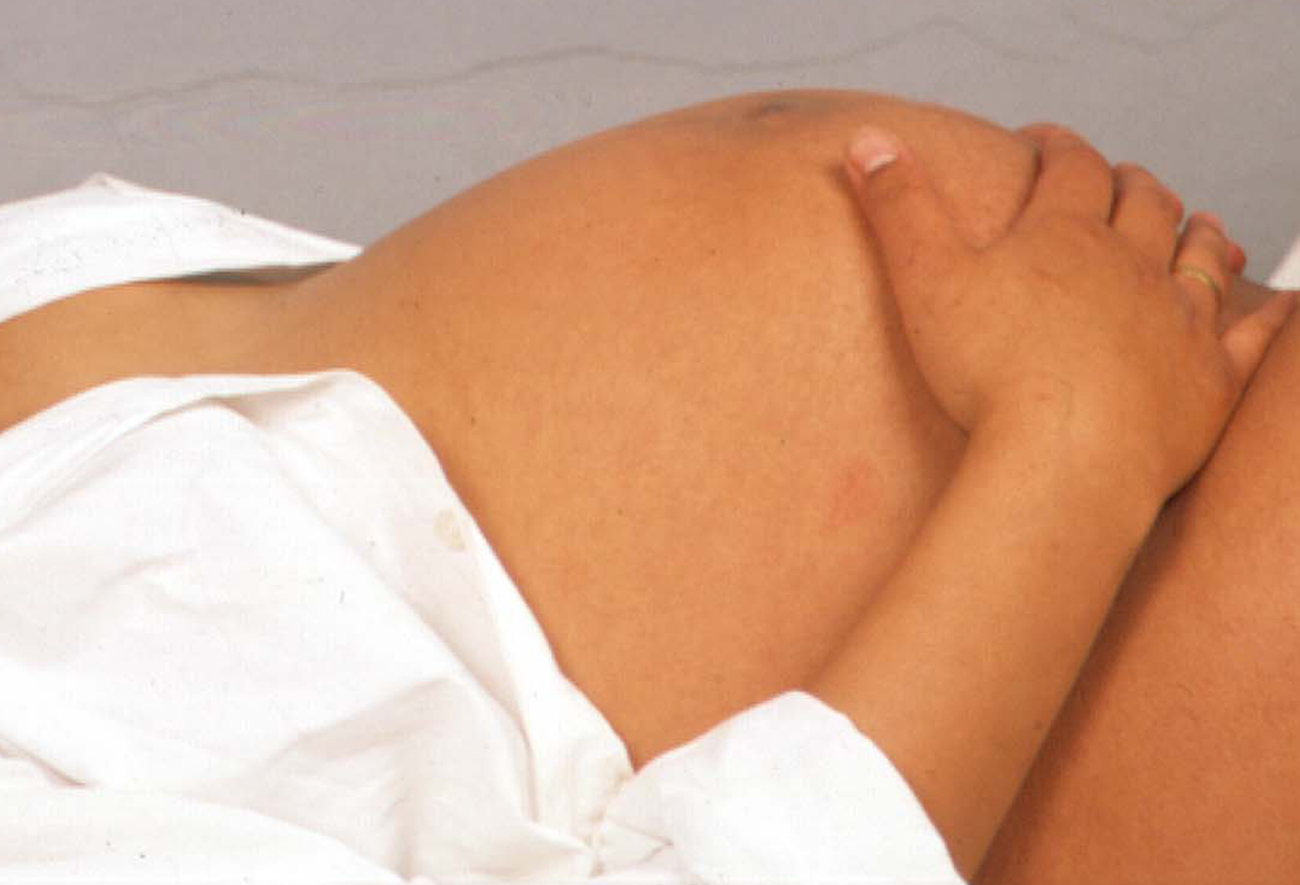 Mujer en estado de gestación