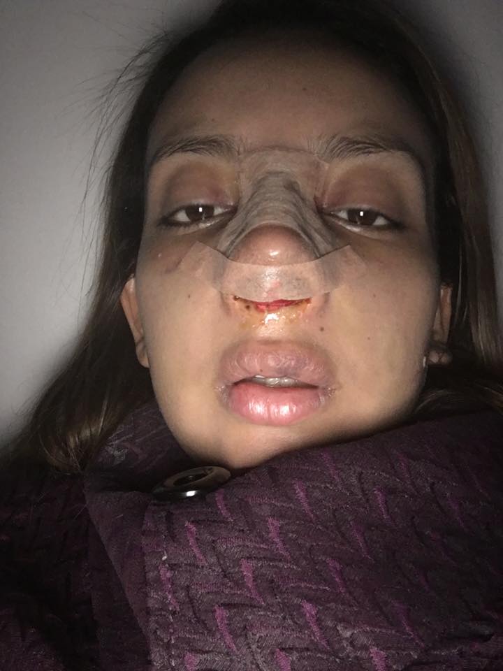 Yamile Arango tuvo que someterse a una cirugía, tras haber sido atacada por su compañero sentimental