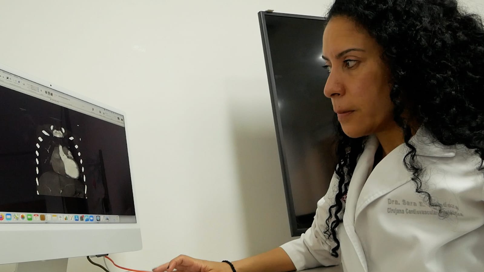Primera mujer en Latinoamérica en implantar un corazón artificial.