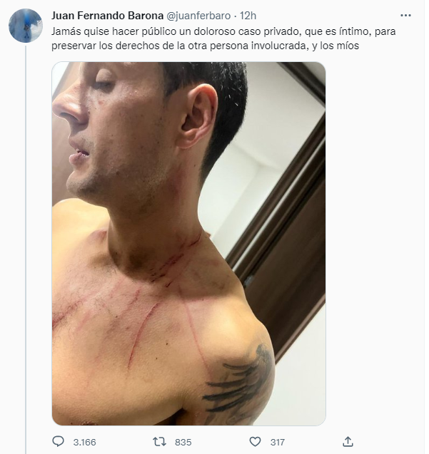 Fernando Barona y los tuits que justifican su actuar Fernando Barona y los tuits que justifican su actuar