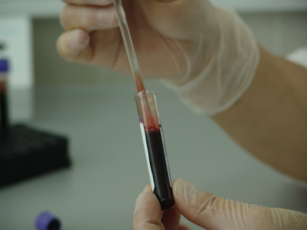 Cuáles son las enfermedades de transmisión sexual más comunes Prueba de sangre