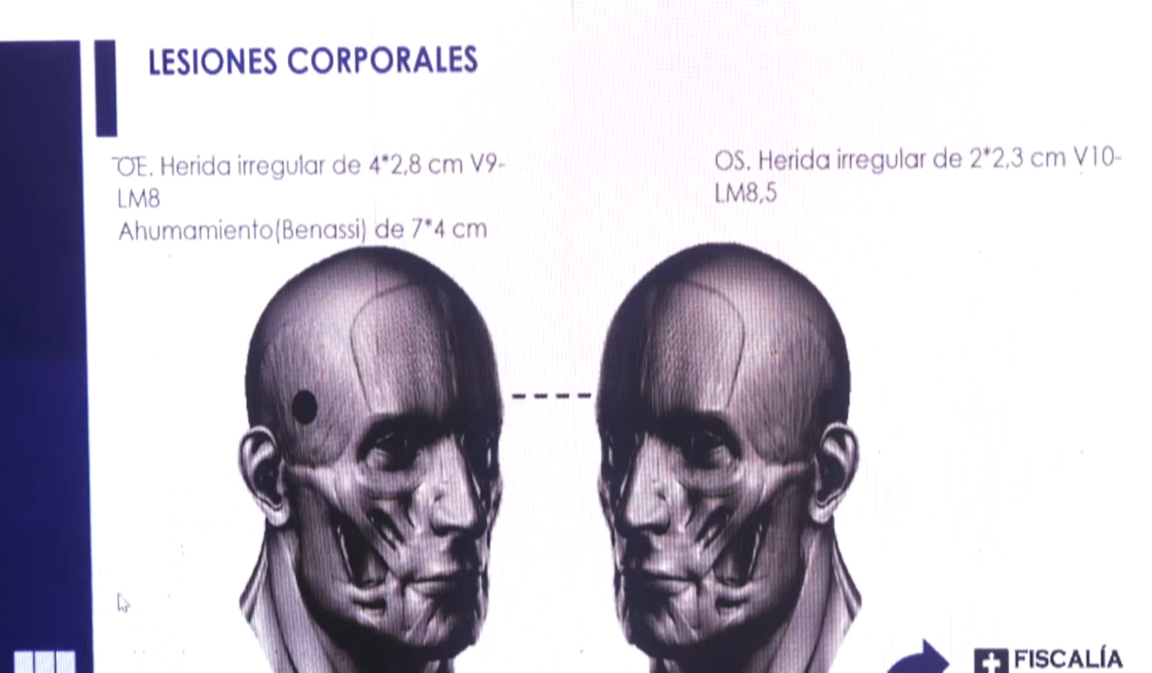 Necropsia de Óscar Dávila 