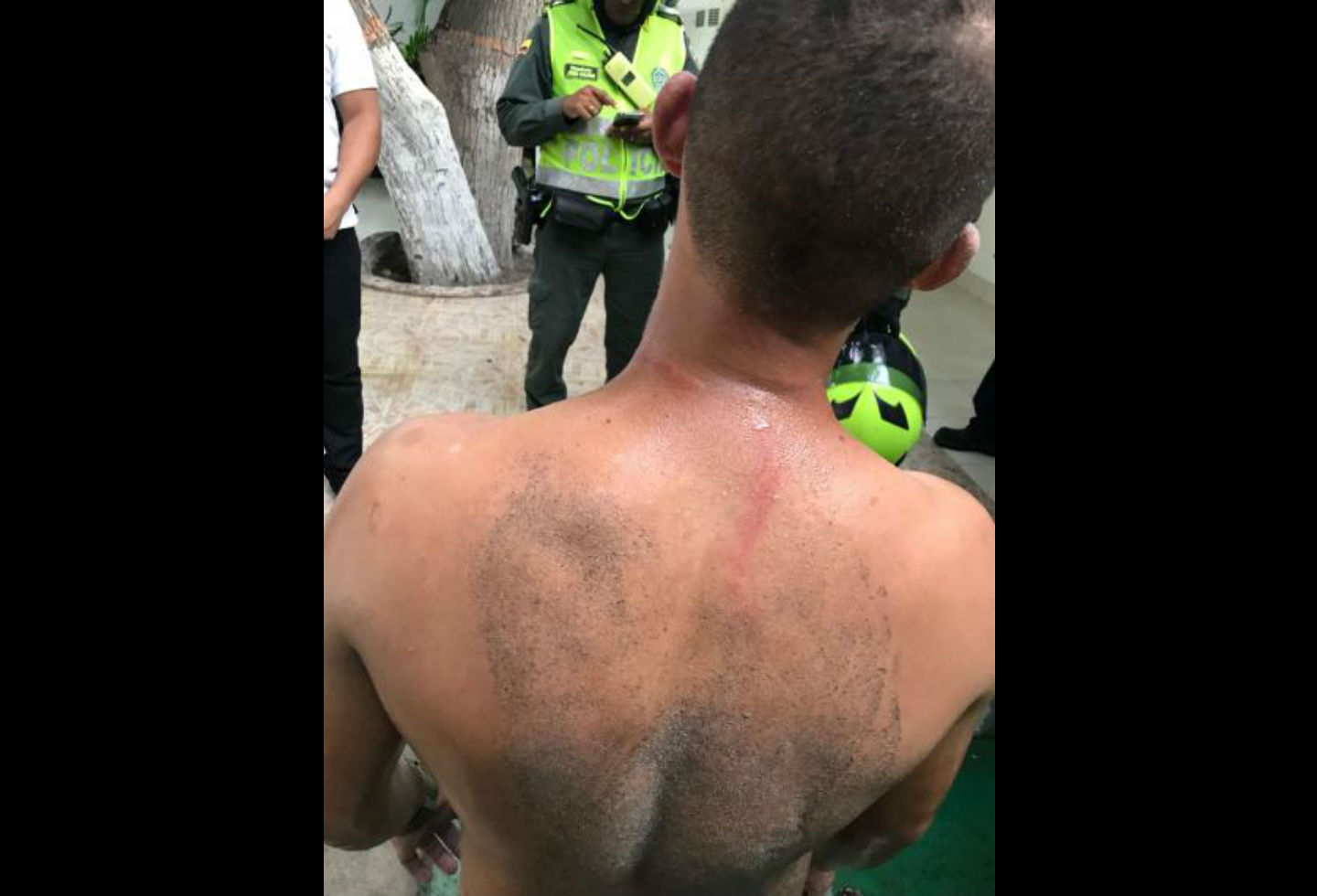 Golpiza a turista en Santa Marta Golpiza a turista