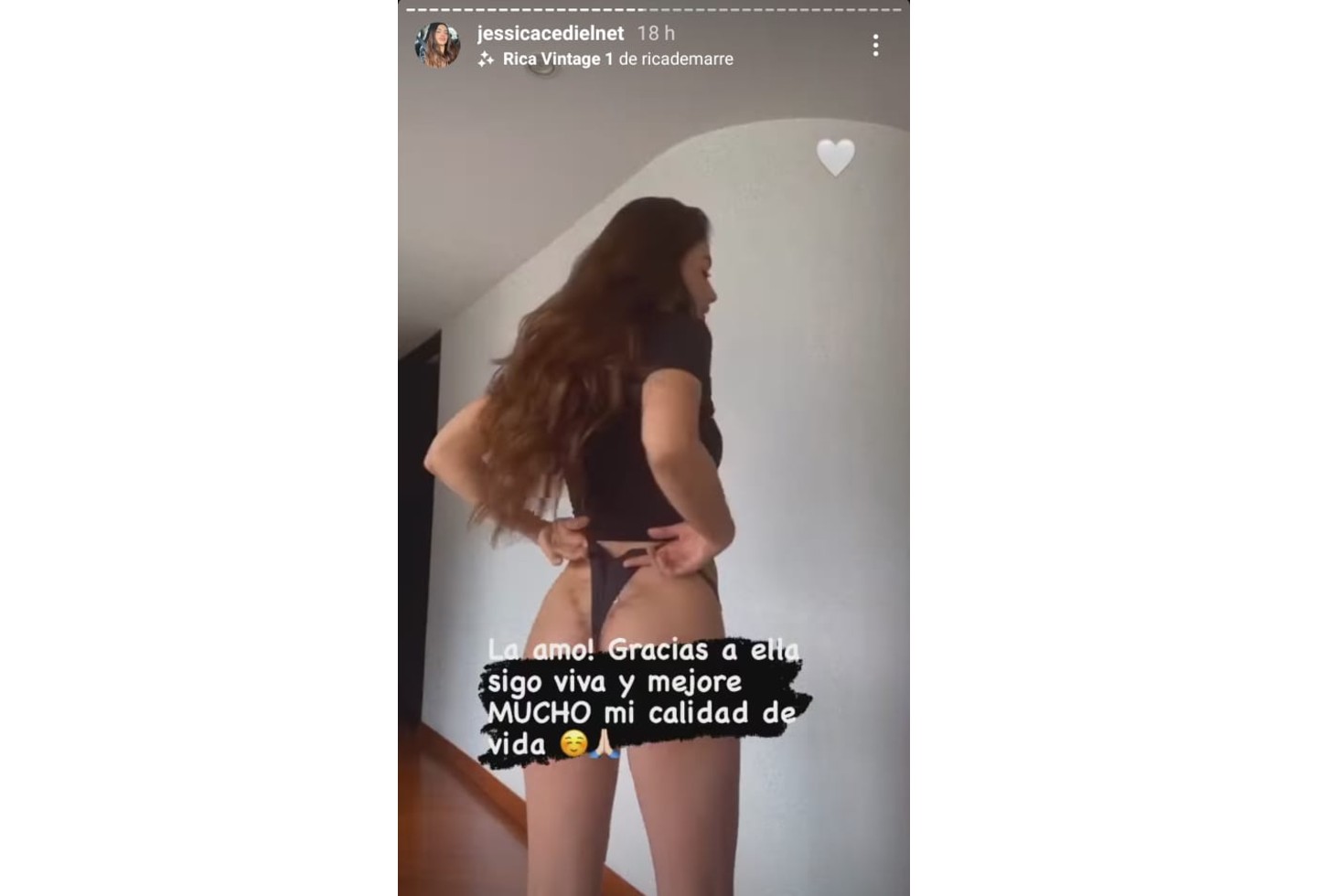 Jessica Cediel y su cicatriz en la cola