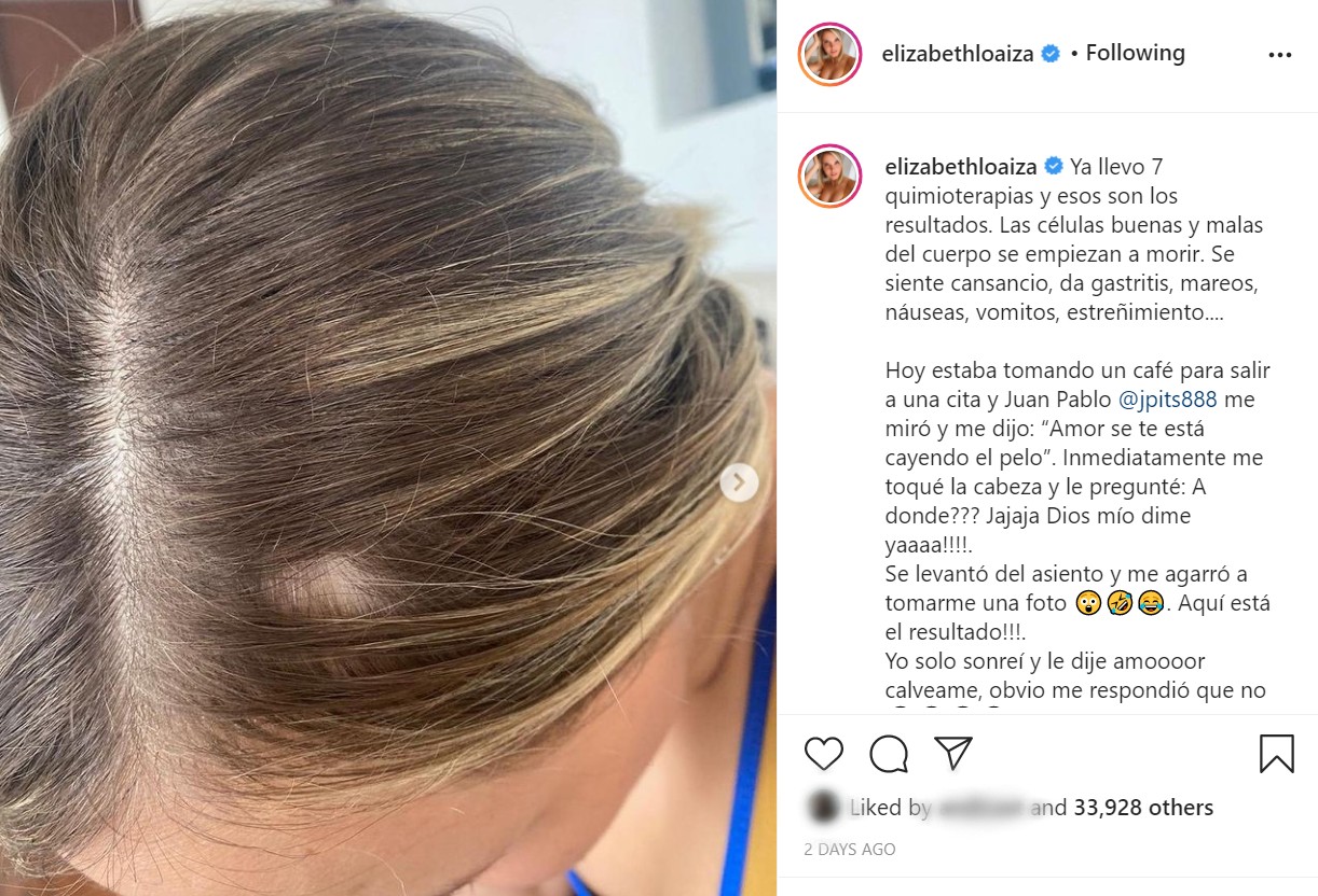 Elizabeth Loaiza muestra la caída de su cabello