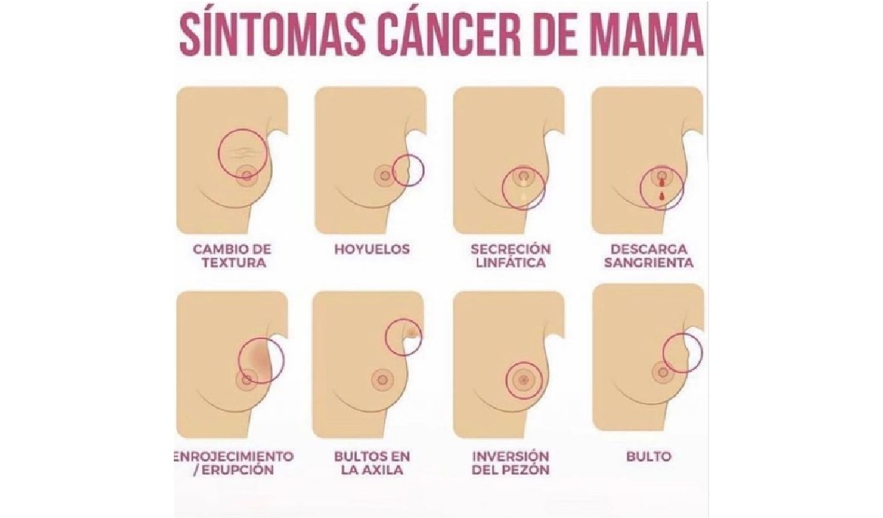 Como hacer prótesis de mama en casa