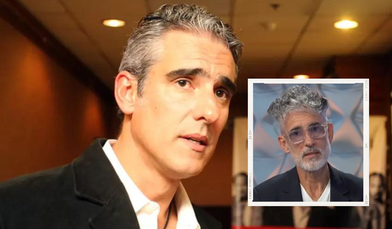 Miguel Varoni se hizo procedimiento para quitarse unos años