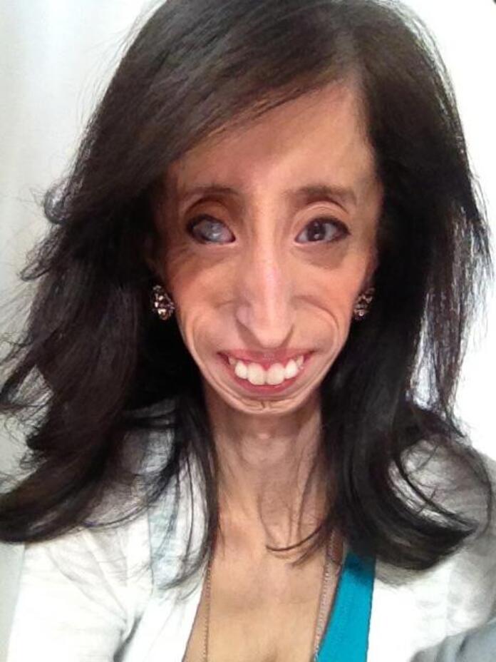 La Historia De Lizzie Velasquez Llamada La Mas Fea Del Mundo Rcn Radio