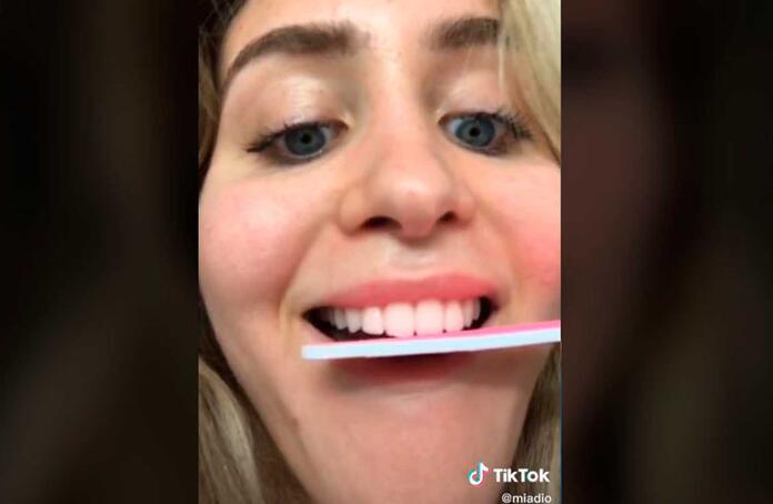 Limarse Los Dientes Con Lima Para Unas La Peligrosa Tendencia Rcn Radio