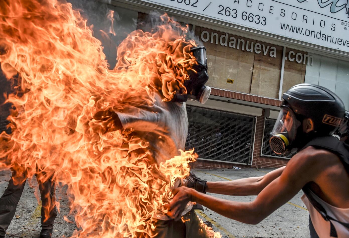 Manifestantes quemados en Venezuela