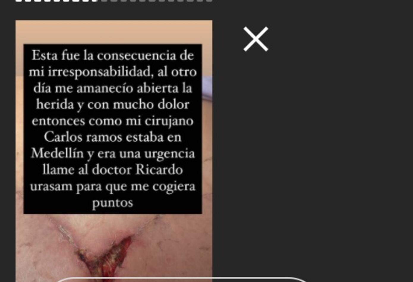 Cirugía a Yina Calderón