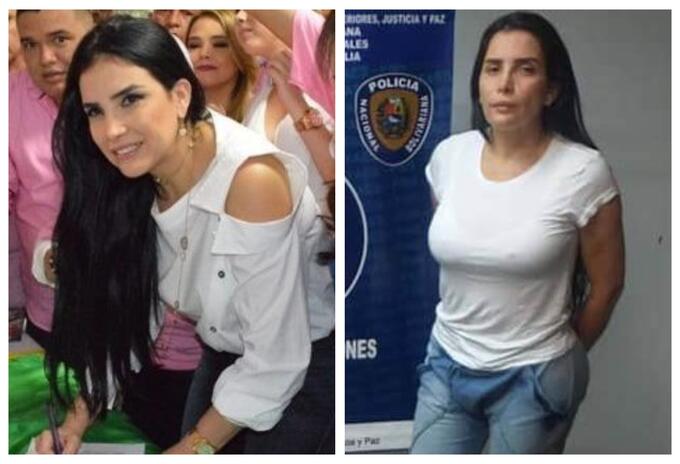 Aida Merlano antes y despúes