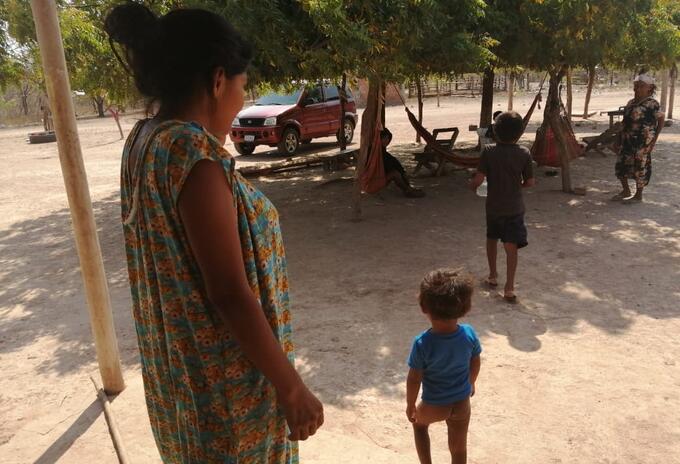 Niños con desnutrición en La Guajira