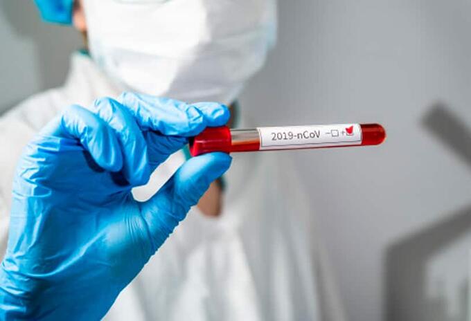 Coronavirus Huila
