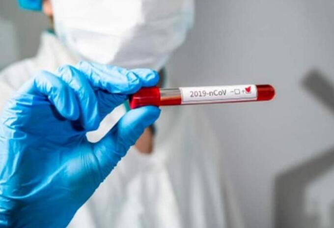 Coronavirus Huila