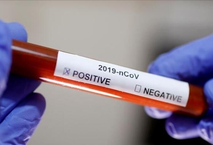 Pruebas de coronavirus en Colombia
