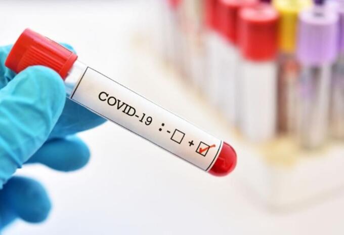 Pacientes con coronavirus