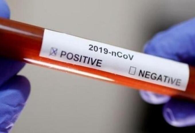 Reporte coronavirus.