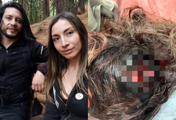 Mujer atacada con un hacha Mujer atacada con un hacha
