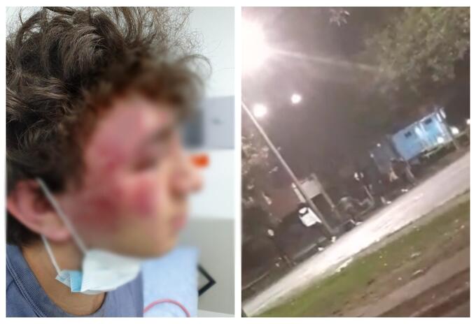 Golpiza a menor en Suba