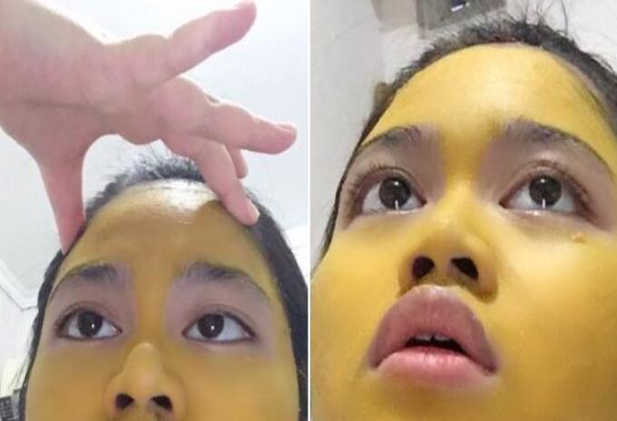 Joven se aplicó mascarilla de curcumá pero no le fue como esperaba