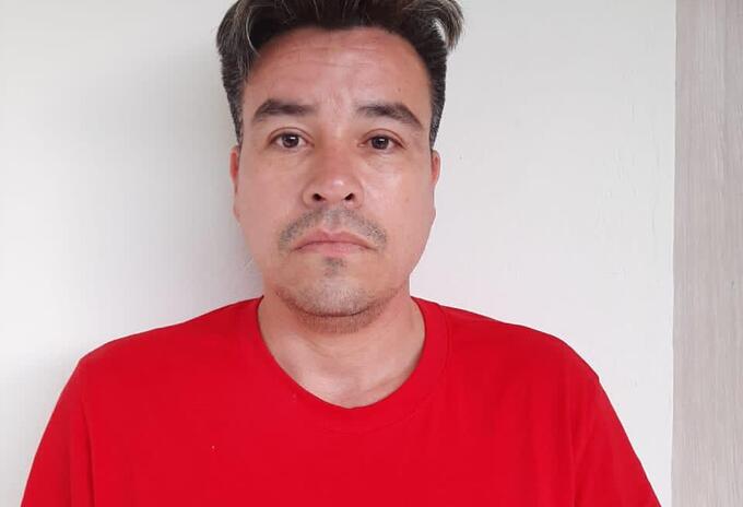El hombre acudía a las cirugías plásticas, para evadir a las autoridades
