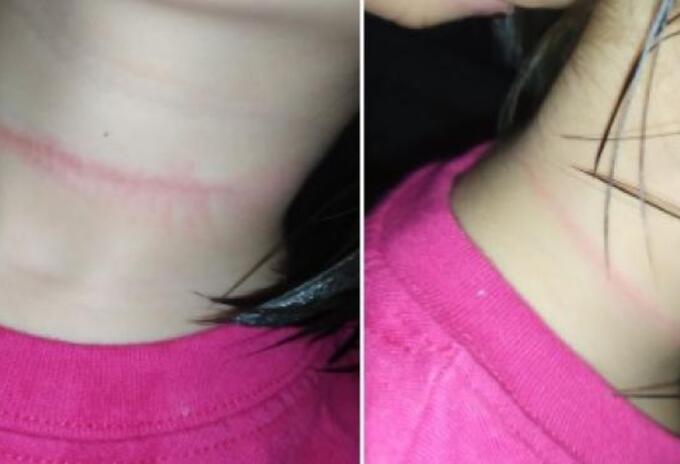 Niña casi se ahorca Niña casi se ahorca