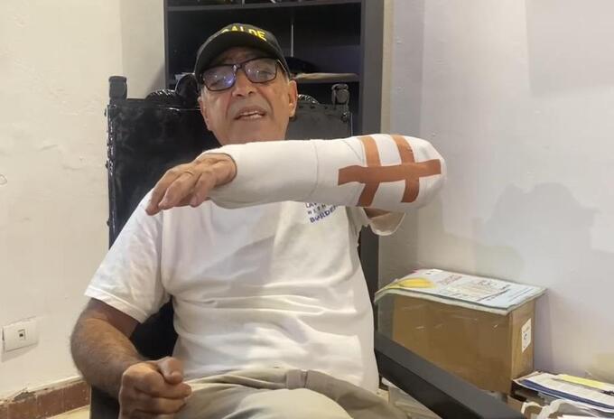 Aparece alcalde Cartagena con el brazo izquierdo fracturado