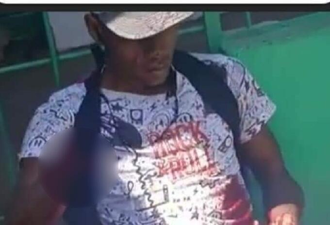 Le cortan la mano a presunto ladrón Le cortan la mano a presunto ladrón