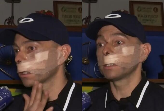 Ciclista agredido por robarlo Ciclista agredido por robarlo
