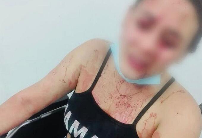 Mujer fue agredida con una botella dentro de un bar.