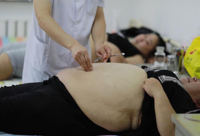 Descubren que fármaco ayudaría a revertir la obesidad