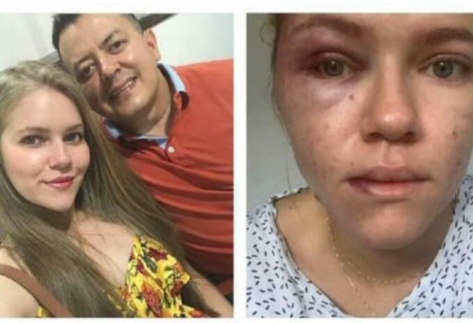 Johana Espejo señala al concejal Deiby Arias de haberla agredido