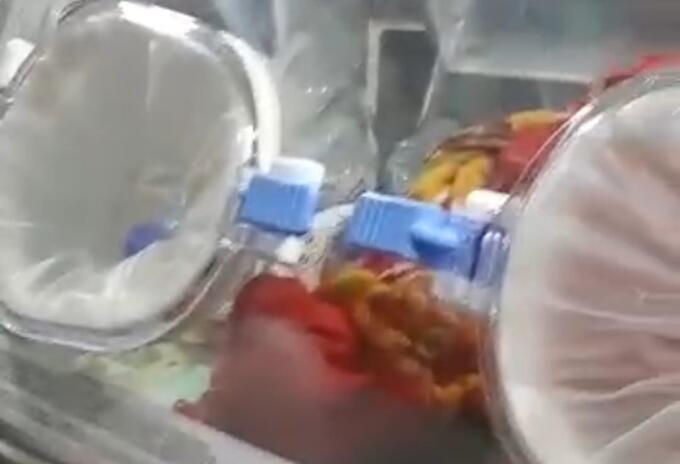 La menor era trasportada en la Ambulancia