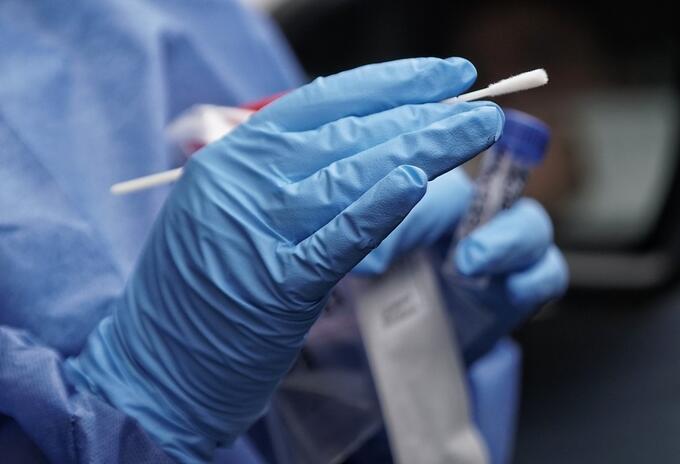 Prueba de coronavirus Prueba de coronavirus