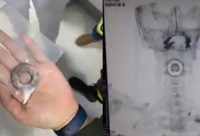 Policía herido Bucaramanga