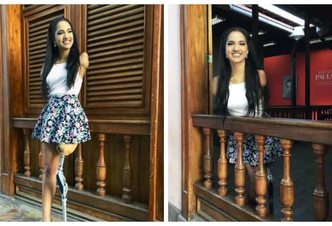 Modelo Victoria Salcedo perdió tres extremidades cuando niña Modelo Victoria Salcedo perdió tres extremidades cuando niña
