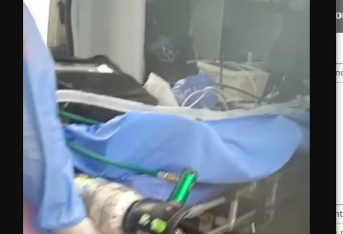 El menor fue trasladado a otro centro asistencial para su recuperación