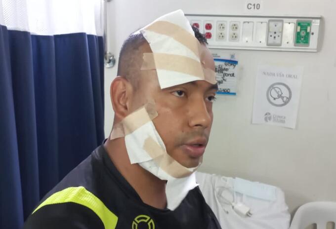 Patrullero de la Policía atacado con ácido en Ibagué.