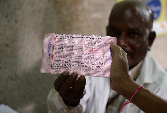 Tuberculosis