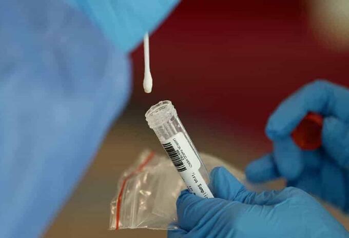 Prueba Ómicron