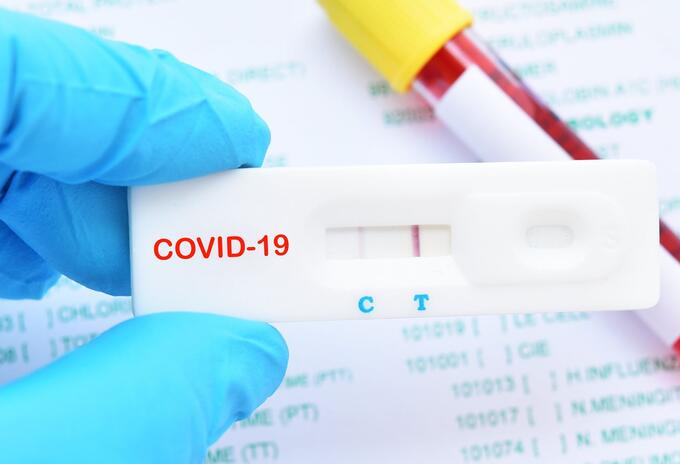 Pruebas caseras de Covid 19