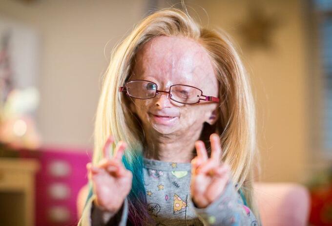 Adalia Rose Adalia Rose