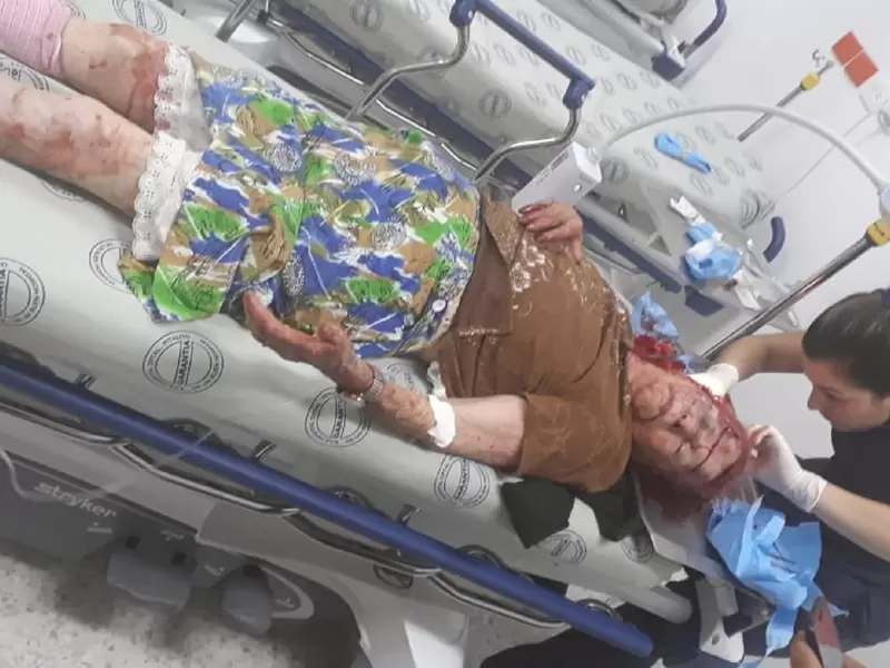 La adulta mayor sufrió graves heridas en el rostro y la cabeza.