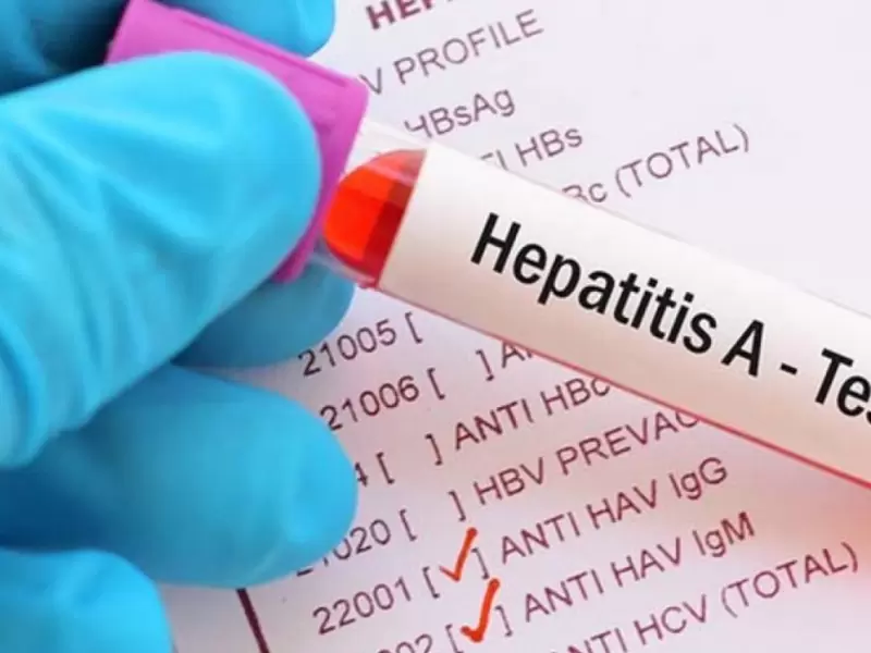 Hepatitis