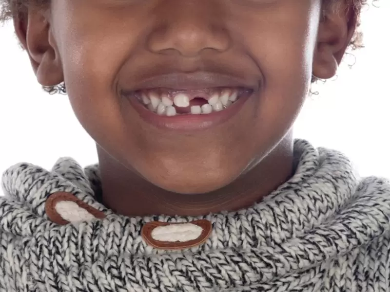 Dientes de leche