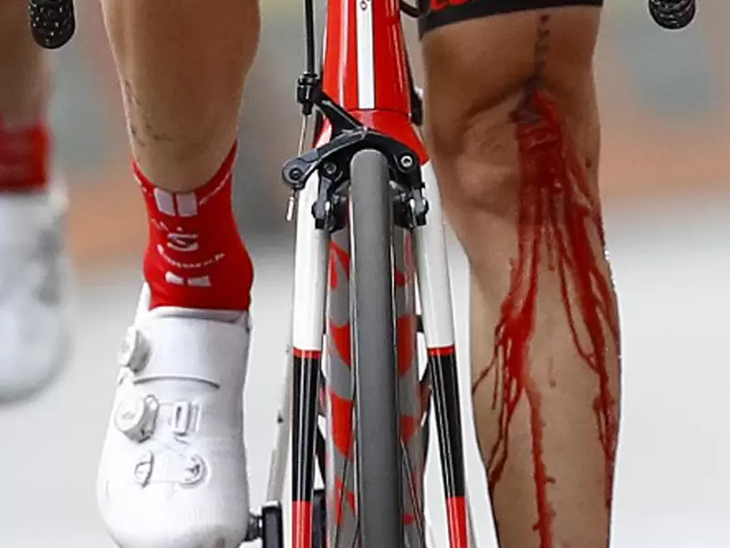 Dumoulin sufrió una dura caída en el Giro de Italia 2019 Dumoulin sufrió una dura caída en el Giro de Italia 2019