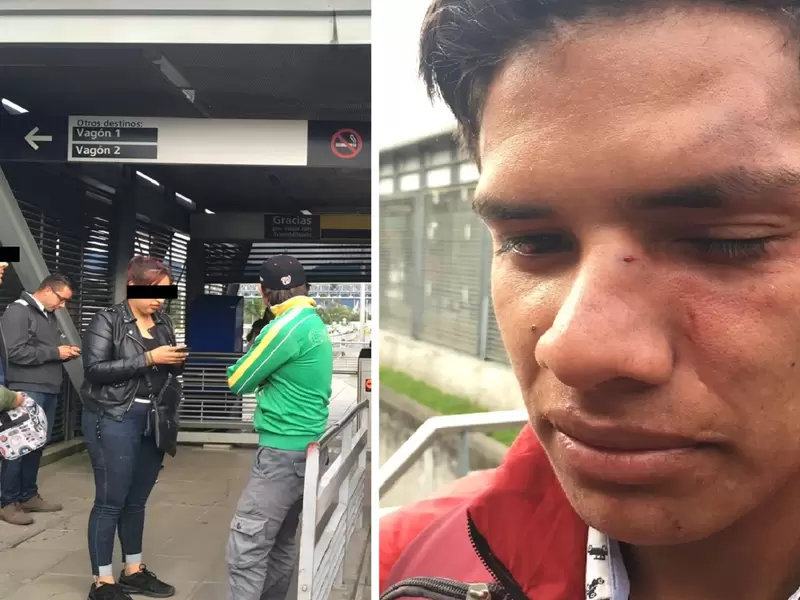 Agredido en Transmilenio