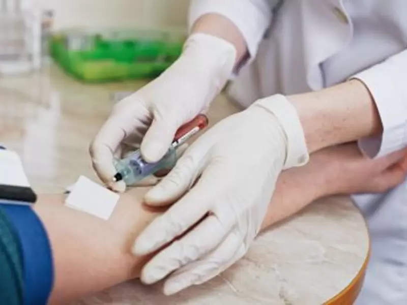 Hepatitis C